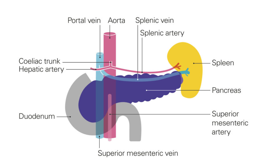 The pancreas is shown in dark purple, with the spleen in yellow on the right (next to the tail of the pancreas) and the duodenum curving round to the left, around the pancreas head. The portal vein and the aorta are shown going vertically past (next to) the pancreas, with smaller blood vessels connecting them to the spleen and other structures in the body.