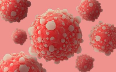 Microscipic view of pancreatic cancer cells.