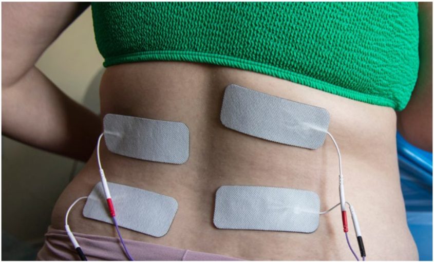 A TENS machine attached to someone's back. 4 wires are stuck to the skin with patches.