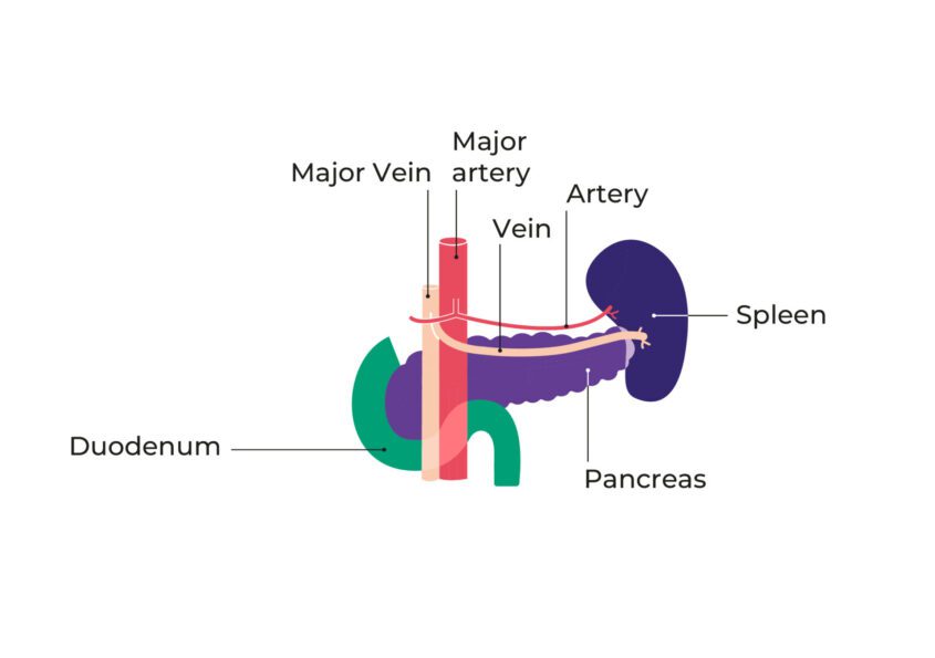 Diagram showing the main veins and arteries around the pancreas, spleen and duodenum